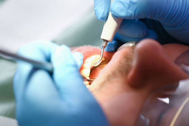  Cameron Park, TX Emergency Dentist Pros