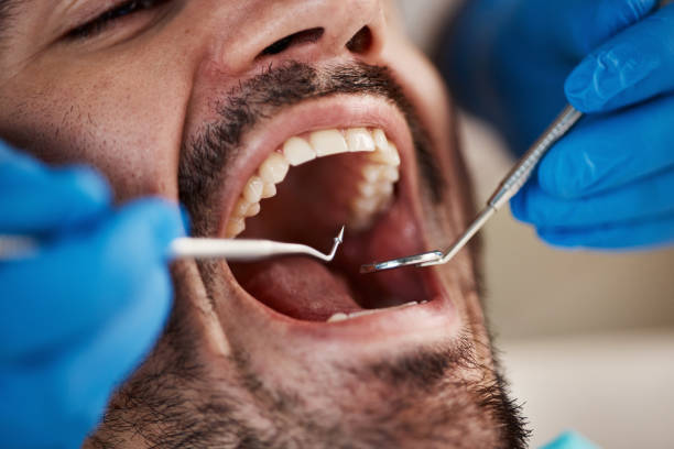 Best Knocked-Out Tooth Emergency  in Cameron Park, TX